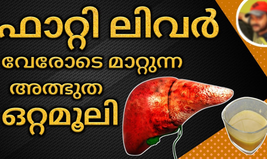 വേരോടെ ഫാറ്റിലിവർ മാറ്റുന്ന അത്ഭുത ഒറ്റമൂലി, എളുപ്പം മാറുവാൻ ചില നാച്ചുറൽ ഒറ്റമൂലികൾ