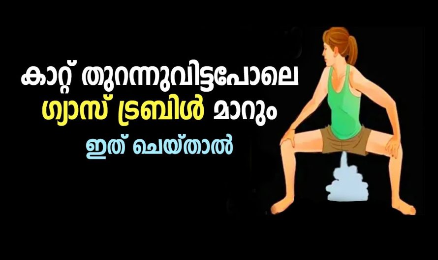 ഇത് ചെയ്താൽ കാറ്റ് തുറന്നുവിട്ടപോലെ ഗ്യാസ് ട്രബിൾ മാറും -Gas problem will change