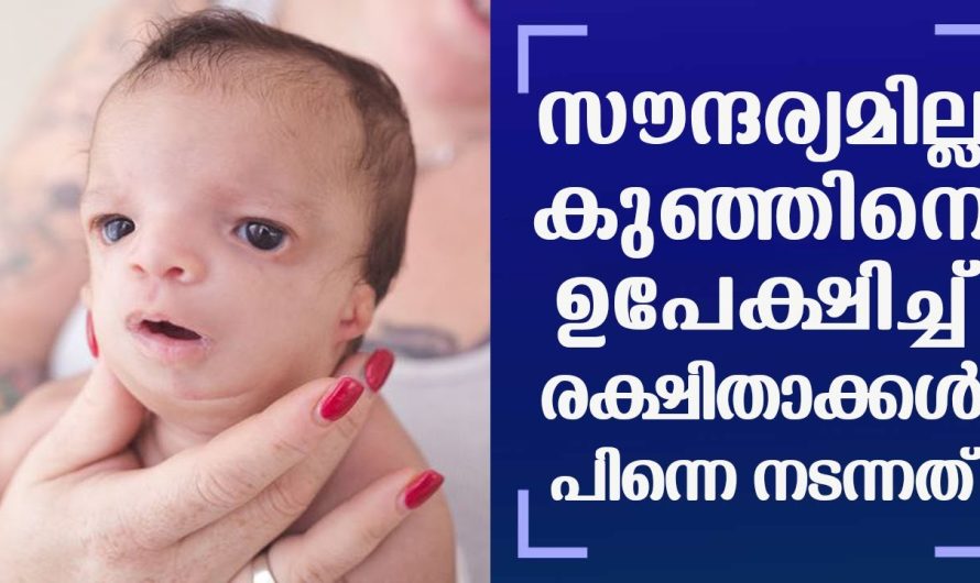 കുഞ്ഞിനെ കാണാൻ ഭംഗിയില്ല ഉപേകിഷിച്ച് മാതാപിതാക്കൾ, പിന്നെ അവിടെ നടന്നത് കണ്ടോ