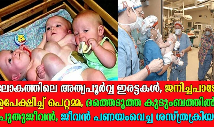 കൈകൾ വിറച്ചു അന്നാദ്യമായി ആ ഡോക്ട്ടറുടെ, ജനിച്ച നാൾമുതൽ വേദന അനുഭവികേണ്ടി വന്ന കുരുന്നുകൾ