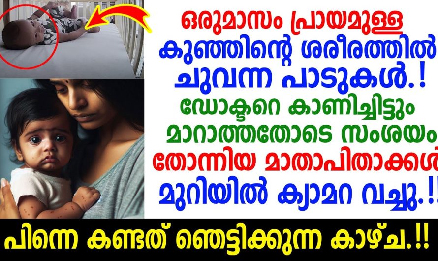 ചുവന്ന പാടുകൾ കുട്ടിയുടെ ശരീരത്തിൽ നിരന്തരമായി ! ഒടുവിൽ സംഭവിച്ചത് കണ്ട് ഞെട്ടി മാതാപിതാക്കൾ