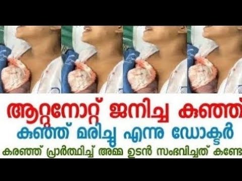 ദൈവത്തിനു എങ്ങനെ കഴിയും ഈ അമ്മയുടെ കരച്ചിൽ കാണാതെ ഇരിക്കാൻ  കുഞ്ഞിന് ജീവൻ വെച്ച നിമിഷം