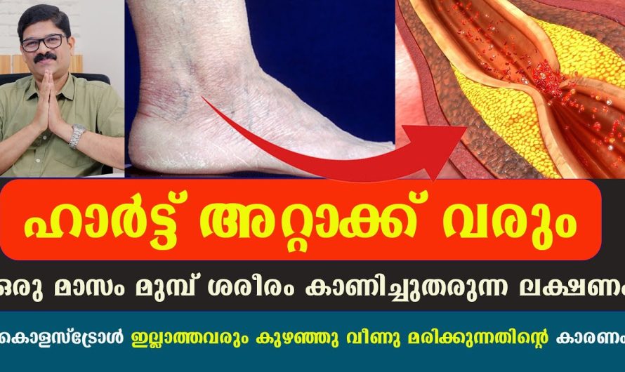 ഒരു മാസം മുമ്പ് ശരീരം കാണിച്ചുതരുന്ന ലക്ഷണം പരിഹാരം, ഹാർട്ട് അറ്റാക്ക് വരും